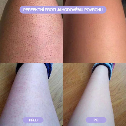 Sunnie: Krystalový Odstraňovač Chloupků