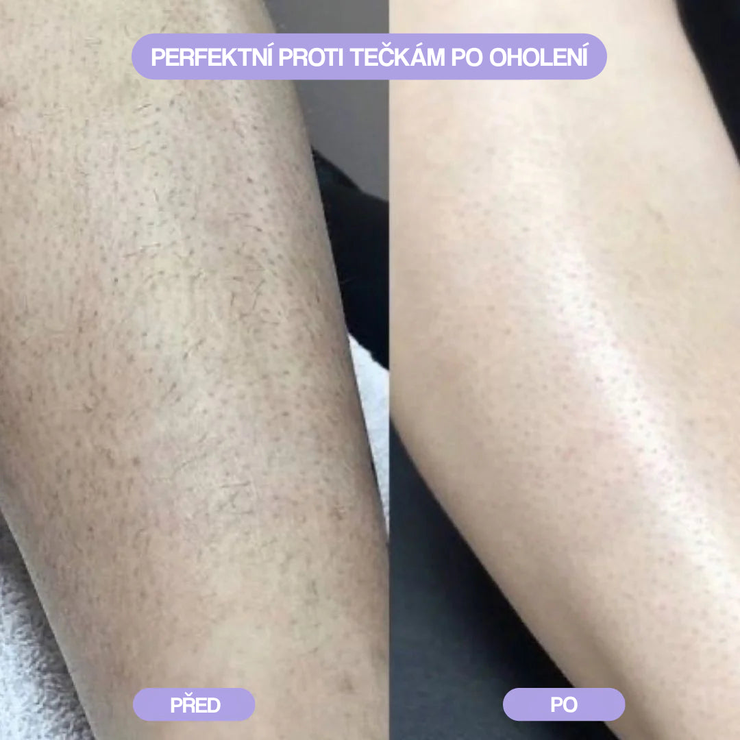 Sunnie: Krystalový Odstraňovač Chloupků